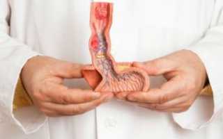 Искривление полового члена у ребенка