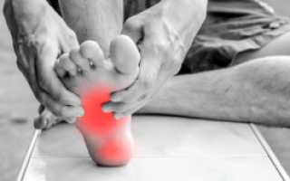 Боли в ногах