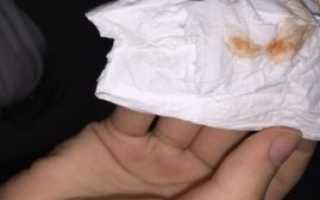 Кровянистые выделения после второго приема Женале