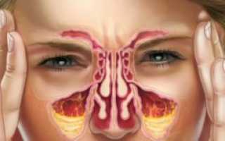 Изменение вкуса после гайморита