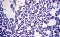 Кокки в мазке