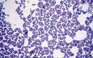 Кокки в мазке