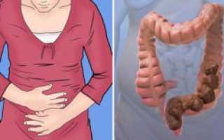 Боль в животе, долго не какать