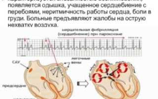 Боли в сердце и учащенное сердцебиение