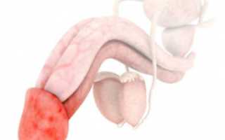 Частичное покраснение плоти вокруг головки