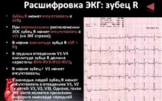 Кардиотренировка, расшифровка экг