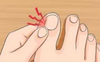 Болит палец на ноге, у основания ногтя