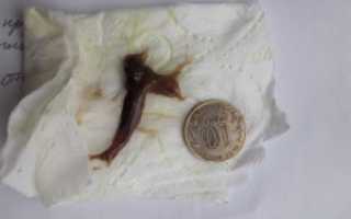 Коричневые выделения При хорошем узи