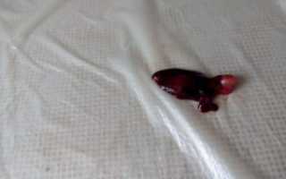 Первые месячные идут 9 дней