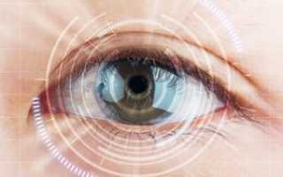 Контактные линзы при катаракте