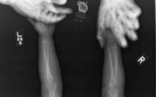 Большое количество рентгенов