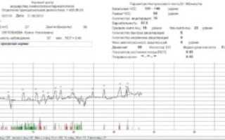 Ктг. Помогите разобраться с поправкой на сон