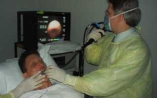 Бронхоскопия после КТ лёгких-необходимость?