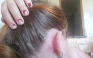 Маленькие шишки за ухом