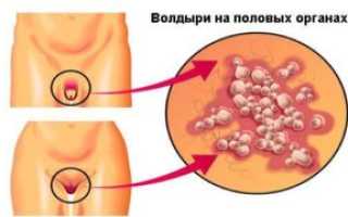 Красные волдыри на половом члене