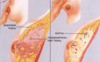 Болит грудь при приеме новинета