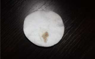 Коричневые выделения при беременности