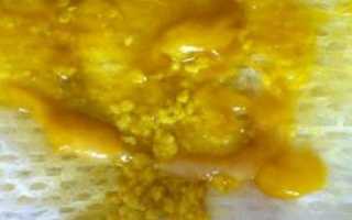 Какает с белыми частичками и слизью