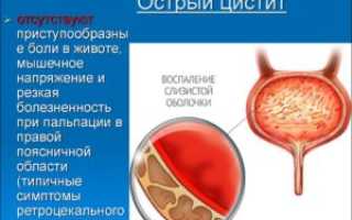 Как вылечить хронический цистит