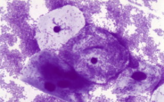 Мазок кокки и ключевые клетки