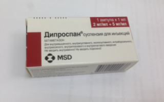Как отказаться от дипроспана