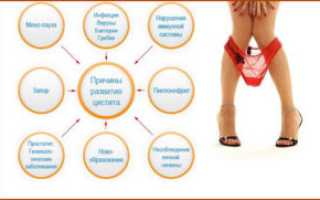 Боли внизу живота когда хочу в туалет