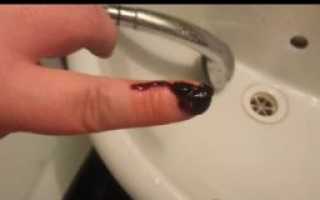 Больно ходить по большому, крови и других выделений подозрительных нет