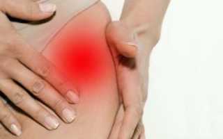 Боли в области таза слева отдающие в ногу