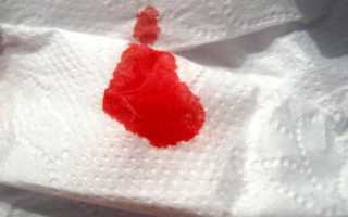 Кровь в кале после удаления геморроя