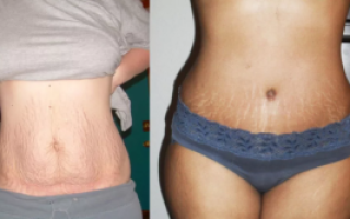 Изменения в теле после родов