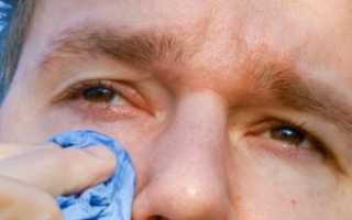 Болят глаза при слезах