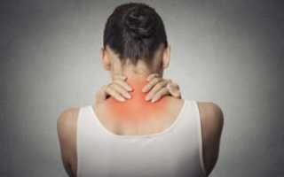 Болит шея сзади