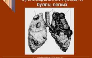 Лечение булл