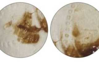 Мажет после мазков