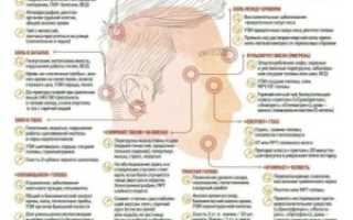 Болит голова сзади вверху (впервые)