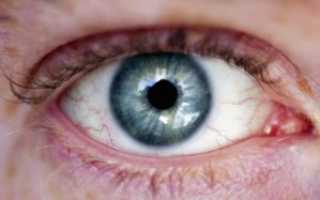 Красные сосуды