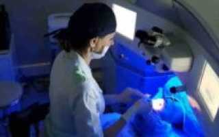 Лазерная коррекция и армия