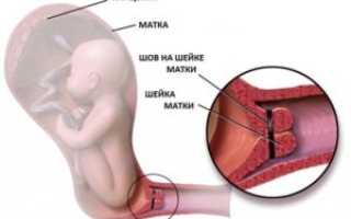Магнезия и шейка матки при беременности