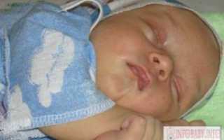 ИМВП 5 месяцев не спит плохо ест тужится