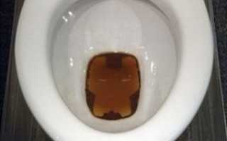 Больно ходить в туалет с кровью