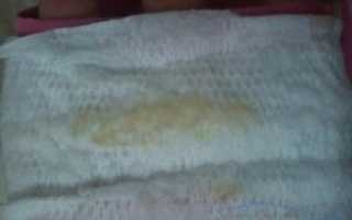 Кравинистые выделения во время приема Регулона