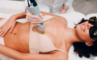 Лазерная эпиляция и волосы на груди