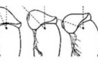Короткая уздечка полового члена, есть проблема или нет