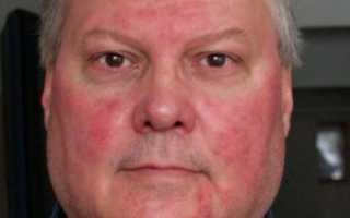 Краснеет лицо и тело после употребления алкоголя