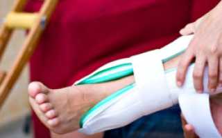 Перелом ноги лечение