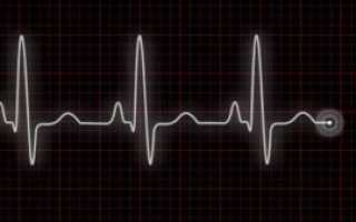 Быстро бьется сердце частый пульс
