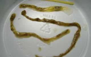 Кал ленточного вида