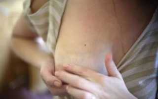 Болит и чешется грудь