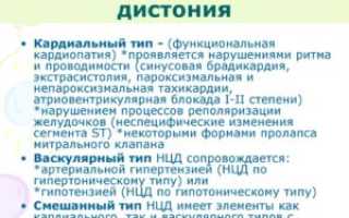 КЦД по кардиальному типу