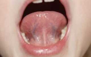 Боль в горле и под языком после сна